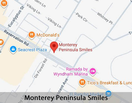 Map image for When Is a Tooth Extraction Necessary in Marina, CA